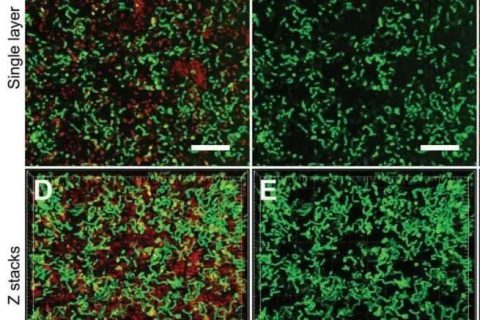 新加坡國(guó)立大學(xué)《AFM?》：肉眼可見(jiàn)！共軛低聚電解質(zhì)助力革蘭氏細(xì)菌的區(qū)分